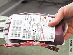 Menschliches Blut aus Blutspenden - Ist ein Impfstoff durch Pyrogene (entzündlich wirkender Stoff, der Fieber auslösen kann) verunreinigt? (Qualitätskontrolle)