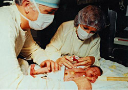Baby Fae war 1984 eines der ersten menschlichen Babys, dessen Leben für die Erforschung der Xenotransplantation geopfert wurde